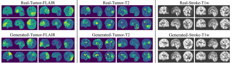 Файл:Generated 3d mri.png