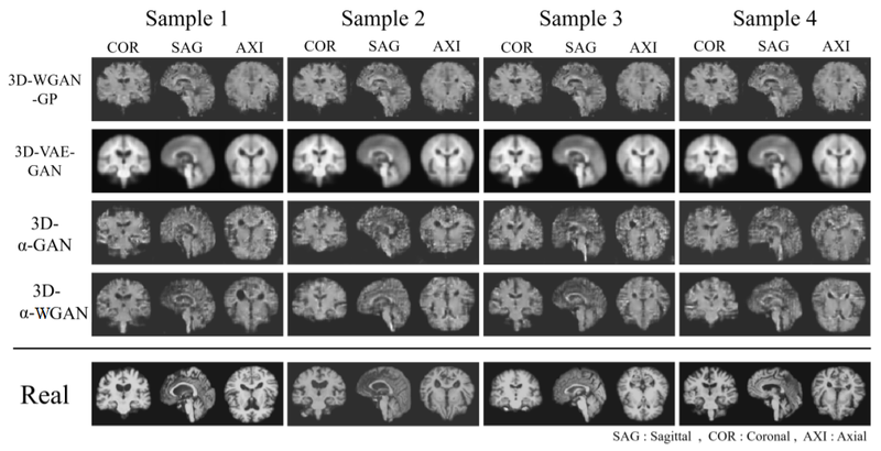 Файл:3d mri models comparison.png